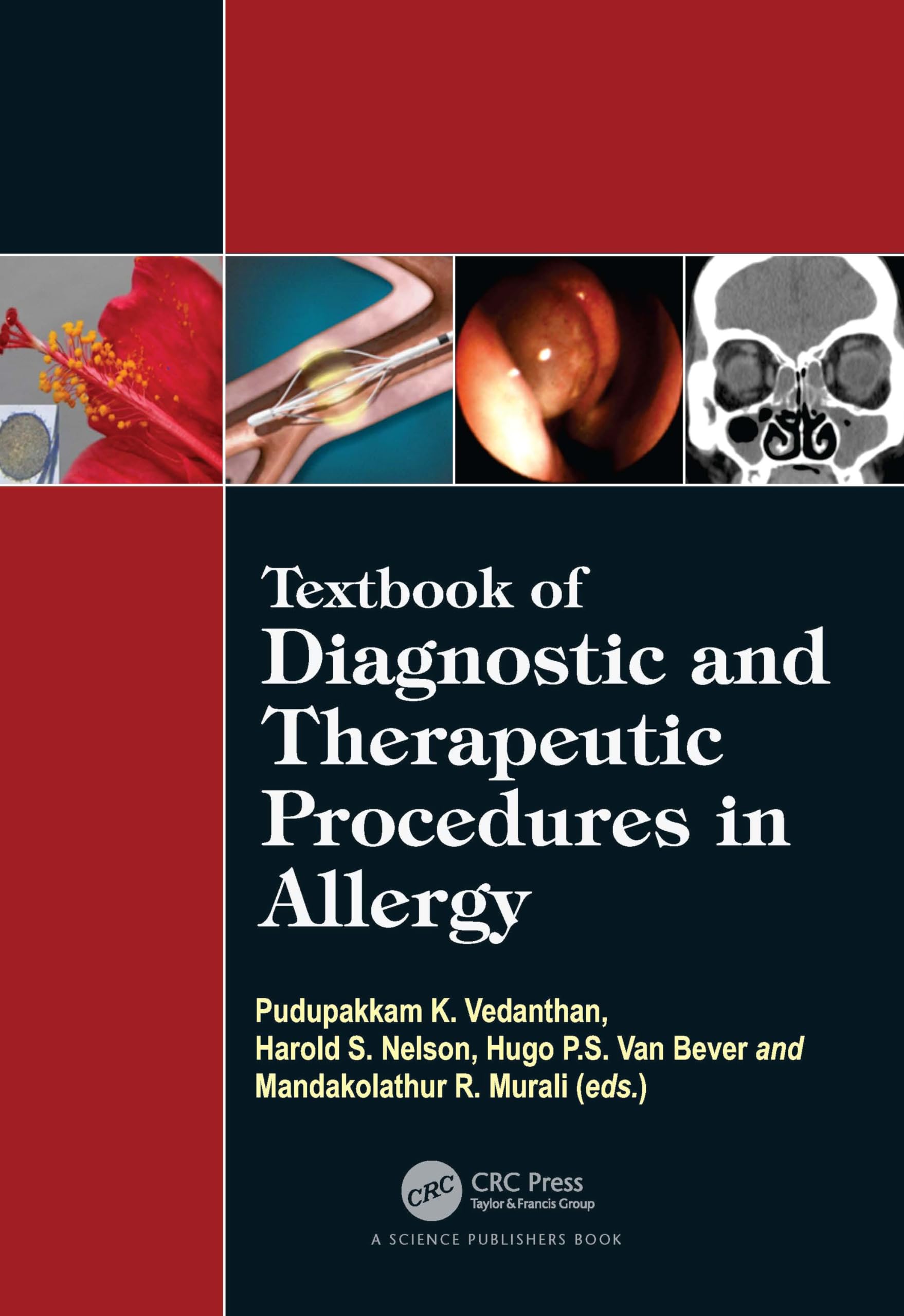 Buy Textbook of Diagnostic and Therapeutic Procedures in Allergy ā BookShops.in