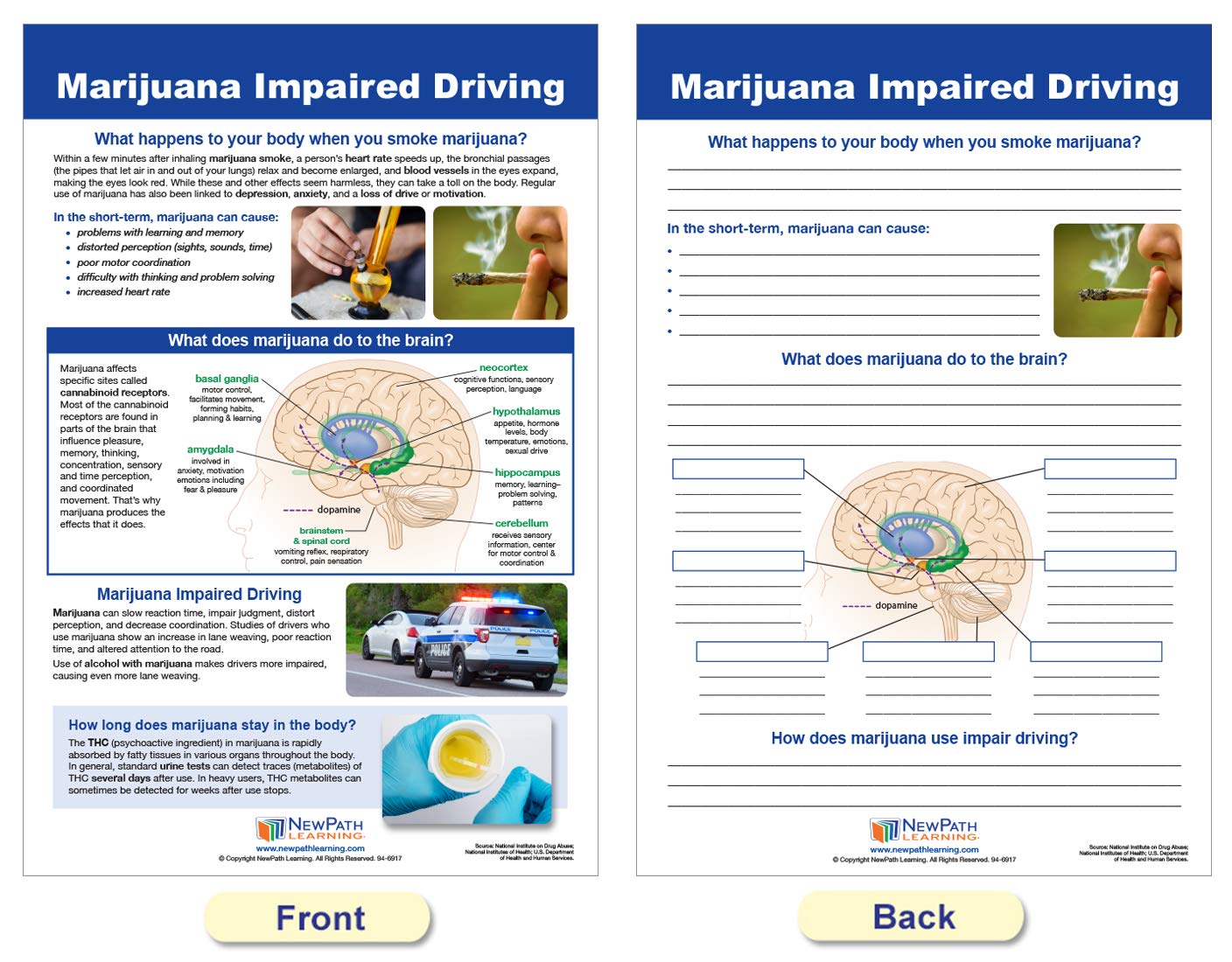 NewPath Learning Impaired Driving Bulletin Board Charts, Set/8 - Laminated, Double-Sided, Full-Color, 12" x 18" (96-6009)