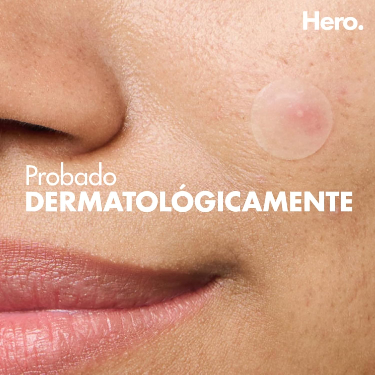 Hero Parches para Acné Mighty Patch Invisible+, Caja con 36 piezas. Delgados para Uso de Día. Absorben Gentilmente las Impurezas en 6 a 8 Horas. No Contienen Medicamento....