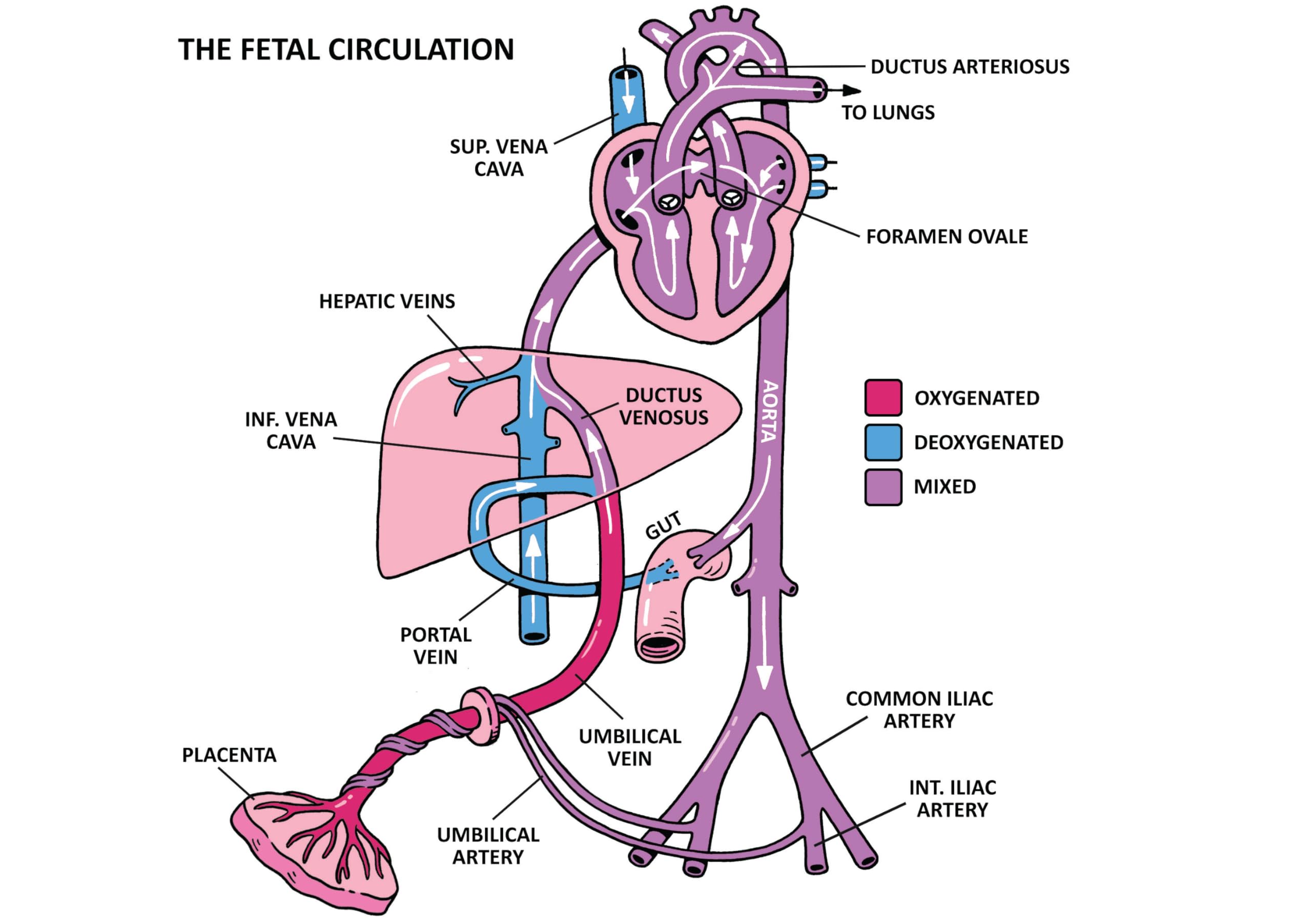 Clinical Pathophysiology Made Ridiculously Simple: Spiral Bound Color Edition