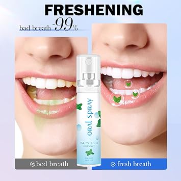 Pro-Biotic Dry Mouth Spray & Breath Freshener Spray, Mint Flavor 20ML, Long-Lasting Moisturizing Oral Care for Bad Breath, Freshens Mouth & Fights Unpleasant Odor