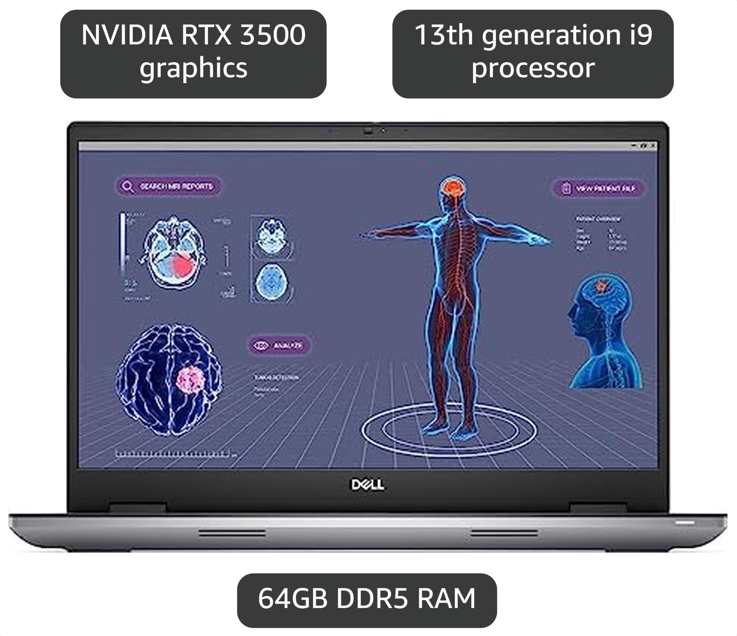 Amazon.com: Dell Precision 7780 Mobile Workstation - 17.3