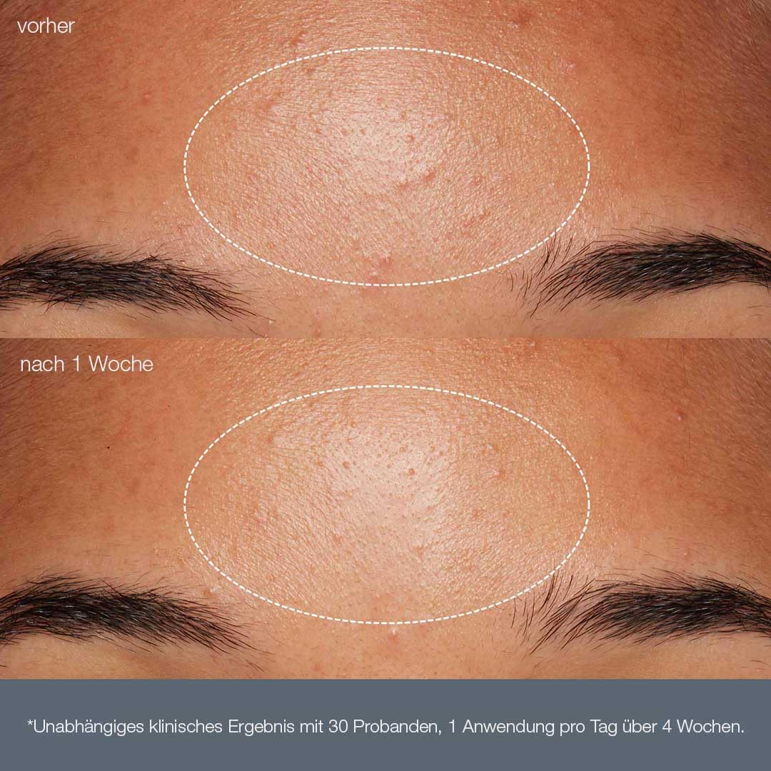 Dermalogica Daily Microfoliant Enzympeeling 74g | Reisbasiertes Enzympeeling mit Salicylsäure und Papain für glattere, strahlendere Haut.