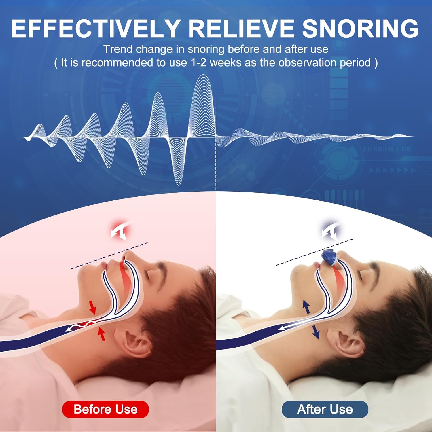 Portable Anti Snoring Devices,Electric Stop Snoring Solution,Adjustable Airflow Snoring Prevention Nasal Dilators for Men Women,Universal All Nose Shapes(Blue) - Image 2