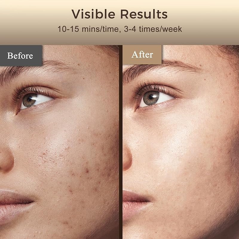 Verfubo Red Light Therapy Face Mask, LED Light Therapy Mask FDA Cleared - 660nm & 850nm for Wrinkles, Collagen & Acne I Adjustable Fit for All Skin Tones I Clinically-Backed 10-Min Daily Sessions image 7