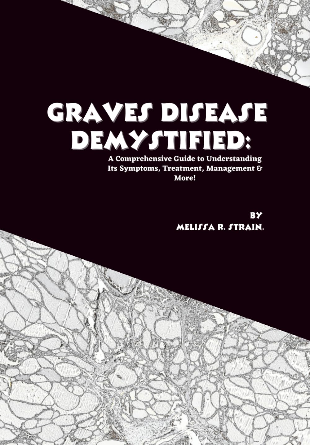 Graves Disease Demystified: A Comprehensive Guide to Understanding Its Symptoms, Treatment, Management & More! (The Body at War: An Autoimmune Series)