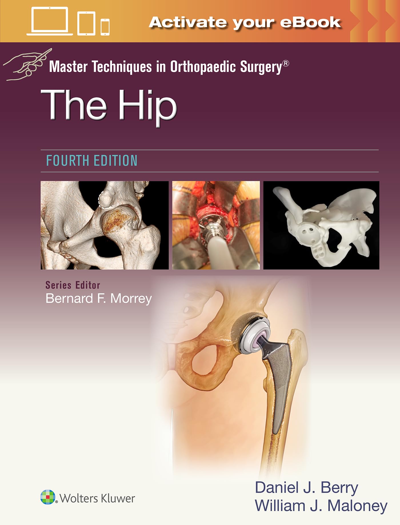 上肢 Surgical Techniques for Masters 71NlmsC6CJL.jpg