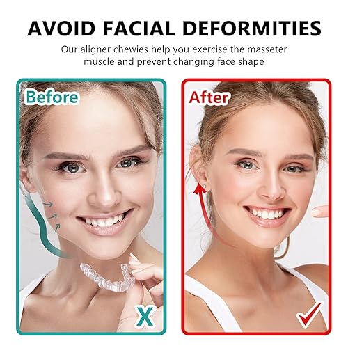 Miniatura 4 de 10 unidades de alineadores masticables para Aligner Chompers masticables para alineador Invisalign, bandejas de alineador de ortodoncia, masticables
