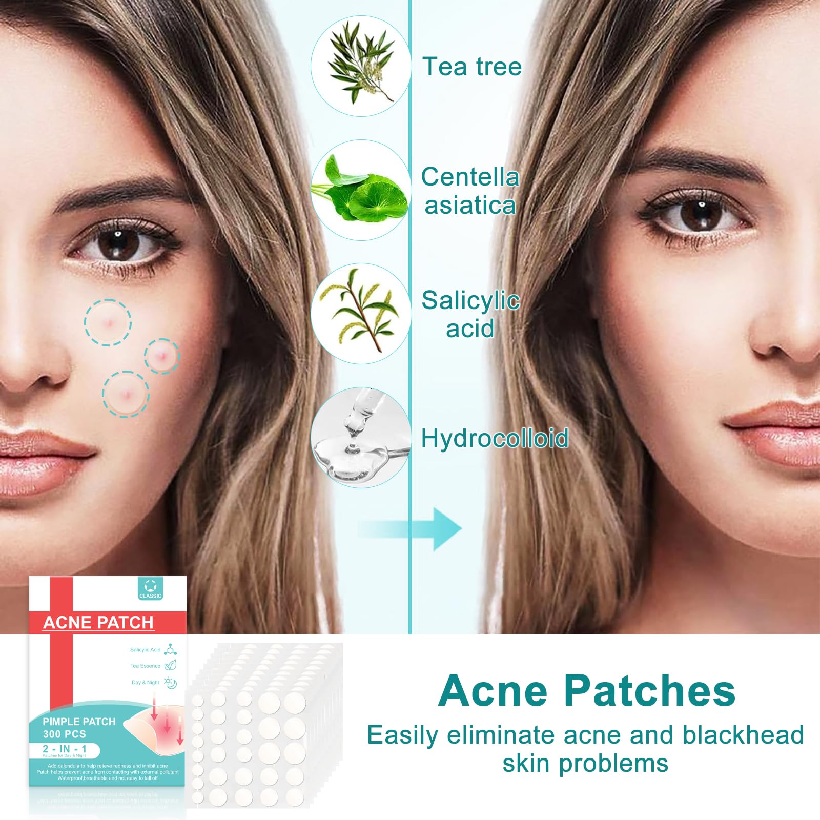 Soodyoow Acne Patches, Pimple Patches, Day & Night Time Acne Treatment, Translucent Hydrocolloid Pimple Patch Spot - Image 3
