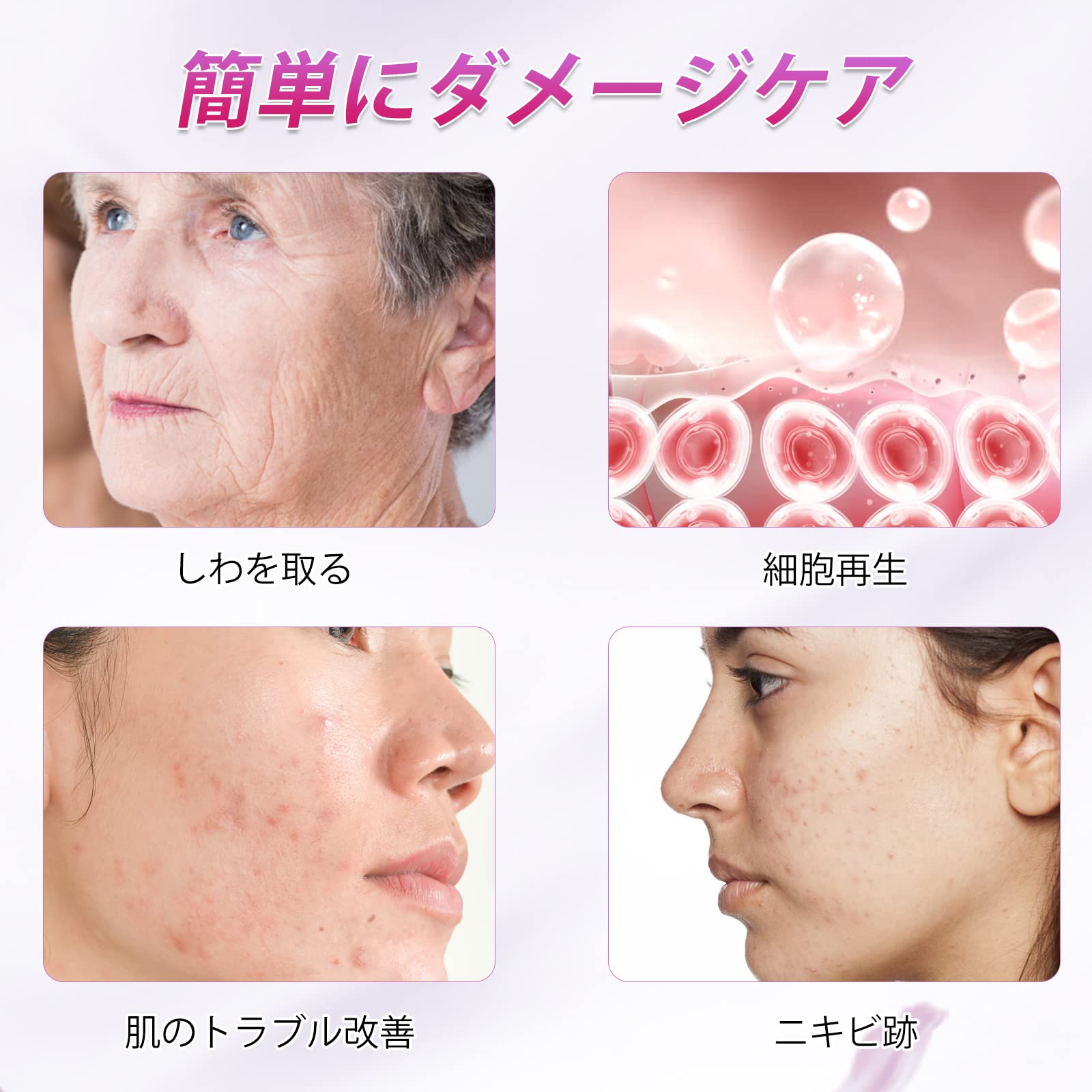 Amazon | SrDiot ダーマローラー 0.2mm マイクロニードルローラー 美顔