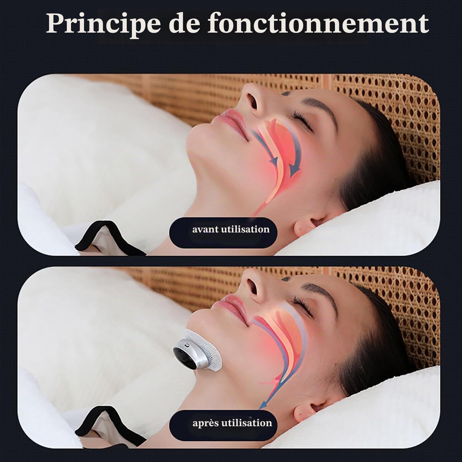 Appareil Anti-ronflement Z3 Pro, Entraîneur Intelligent De Sommeil Profond Par Micro-stimulation, Solution D'amélioration Portable Réglable À 3 Vitesses For Une Respiration Meilleure Et Douce