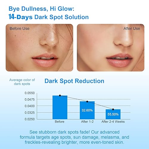 Miniatura 2 de Eliminador de manchas oscuras para cara, corrector de manchas oscuras, suero de manchas oscuras para manchas solares, manchas de la edad, manchas