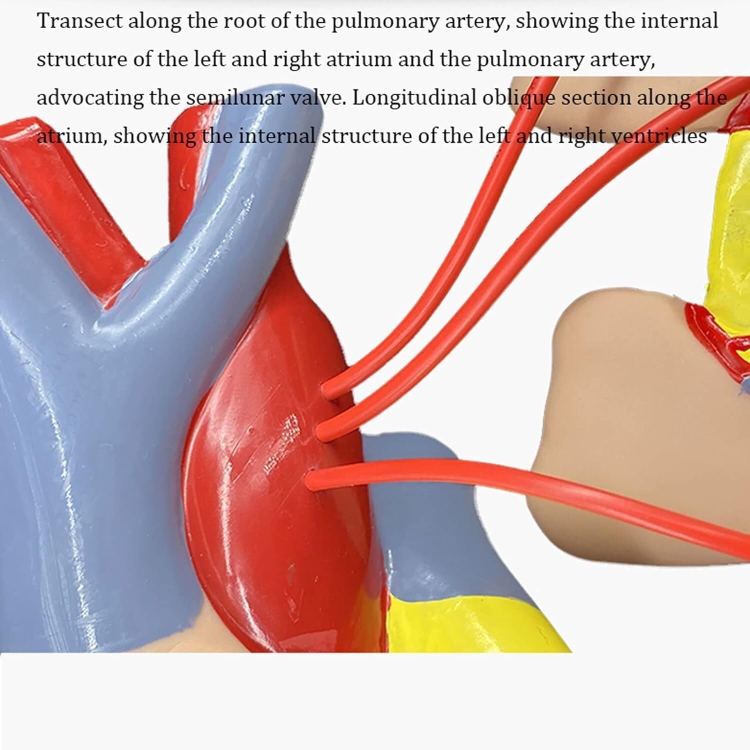 Herramienta De Enseñanza Modelo De Derivación Cardíaca Anatomía, Corazón Humano Con 2 Partes Desmontables Para Laboratorios Cardíacos, Enseñanza Médica Anatomía Médica