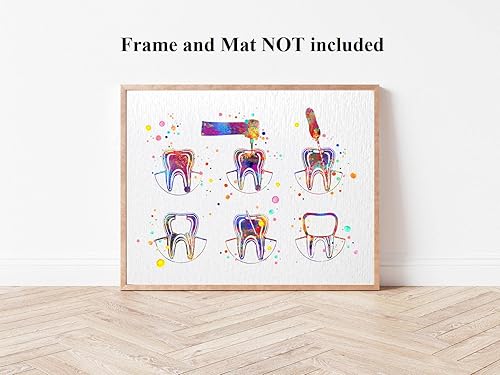 Miniatura 6 de Dignovel Studios 8X10 sin marco Endodoncia Terapia Tratamiento Dental Acuarela Arte Impresión Tratamiento de conducto radicular Clínica Dental