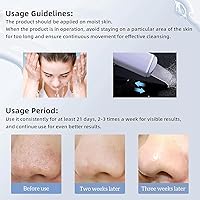 Vista 7 de GUGUG - Espátula para la piel, espátula facial, limpiador de poros, herramientas removedoras de puntos negros para limpieza profunda facial - 4