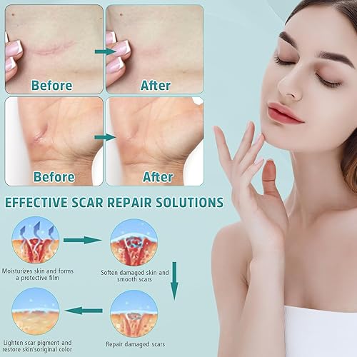Miniatura 4 de Crema avanzada para cicatrices, gel de silicona para cicatrices, crema profesional para eliminar cicatrices quirúrgicas, estrías, cicatrices viejas