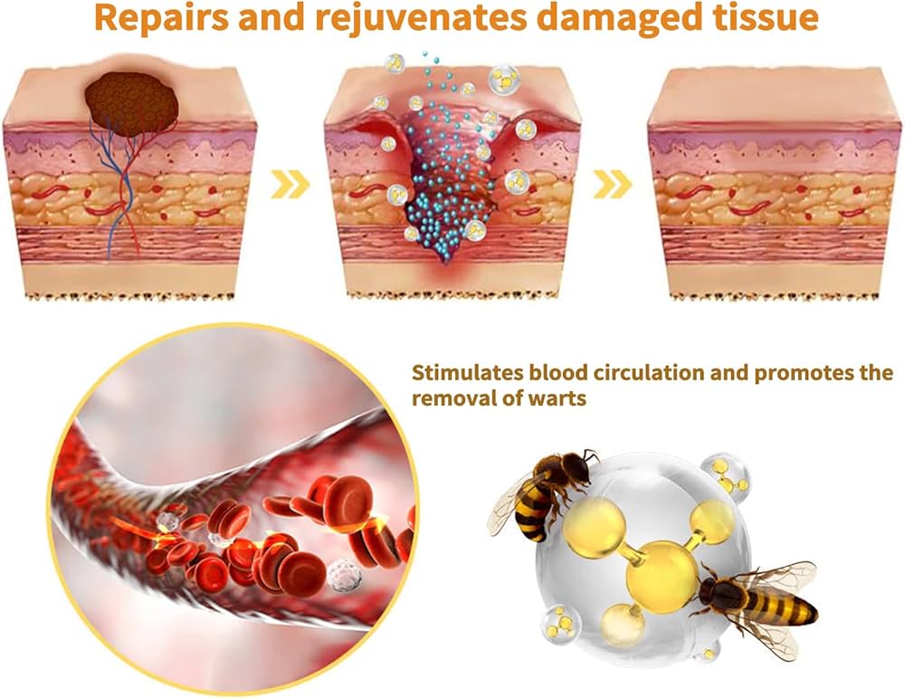 Amazon.com: Zoencgz Bee Venom Correcting Cream, Professional for