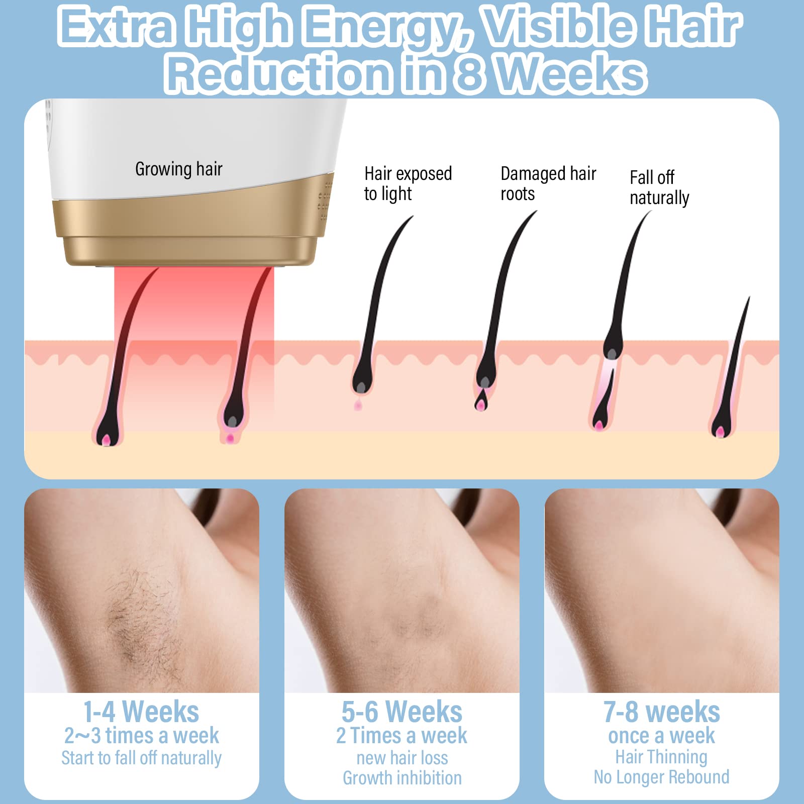 Depiladora láser IPL, 5 niveles y 2 modos, 999,900 Flashes Depilación para mujeres y hombres, Cara, Cuerpo, Bikini, Axilas