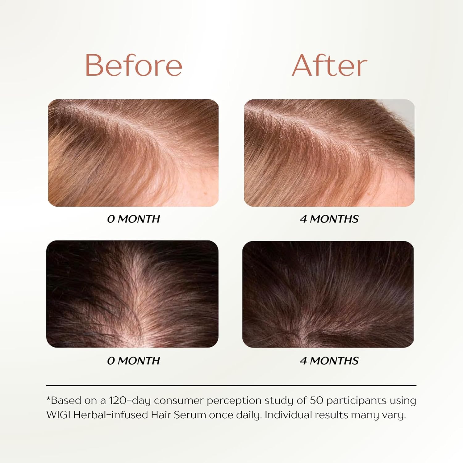 WIGI Hair Serum - Fast Absorbing, Water Based, Herbal Infused, Lightweight & Non Greasy Formula for Thicker, Fuller Hair - Scalp & Hair Scalp Serum for Frizzy, Damaged Hair