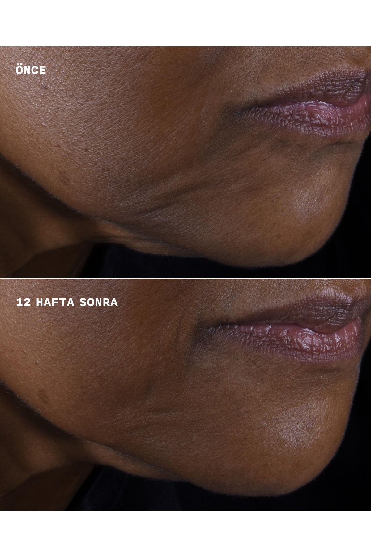Smart CLINICAL REPAIR Firmness + Crema Lifting Cream for Face and Neck