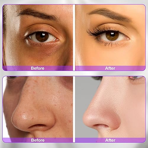 Miniatura 8 de Electrodo Wand Tubo de vidrio Piezas de repuesto de mano para instrumentos de alta frecuencia Elitzia ETJX006AS (punta violeta)