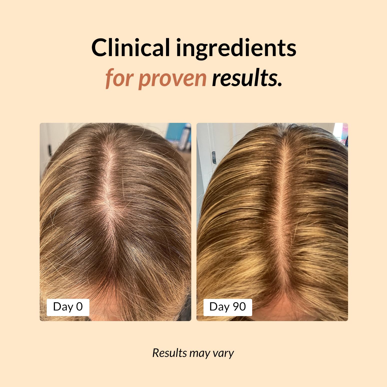 FullyVital Enhance Hair Growth Serum - Science Backed Hair Serum For Thicker, Fuller Looking Hair - Vegan and Lightweight - 1.7 FL OZ 1 Bottle