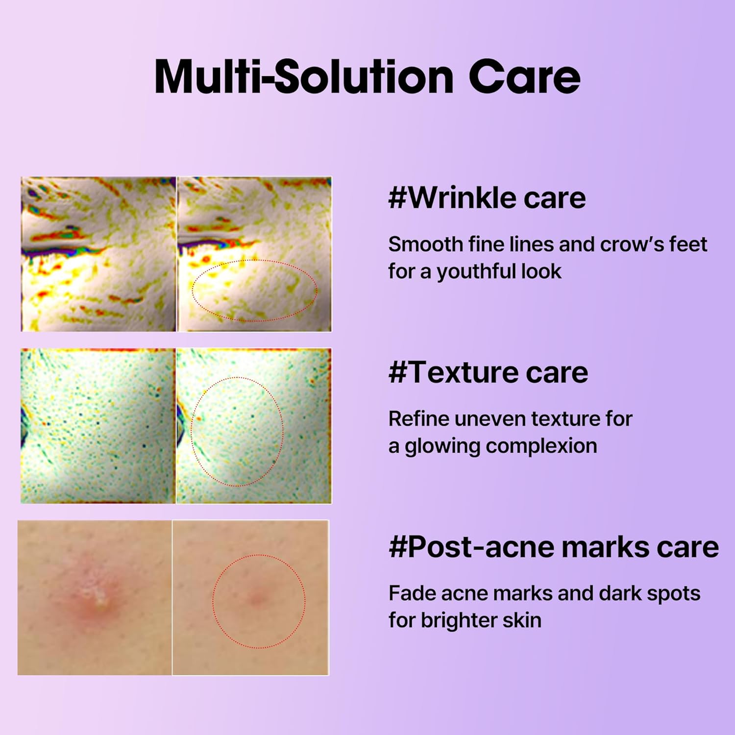 SOME BY MI Retinol Intense Reactivating Serum – 1.01oz, 30ml – Korean Bakuchiol Retinol Serum for Face Firming – Improves Signs of Aging, Minimizes Pore Size & Refines Skin Texture – Korean Skin Care - Image 5