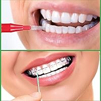 Vista 4 de Patelai 350 piezas de cepillo interdental hilo dental herramienta de limpieza de dientes palillo de dientes cabeza de hilo dental Flosser oral