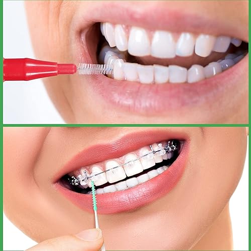Miniatura 4 de Patelai 350 piezas de cepillo interdental hilo dental herramienta de limpieza de dientes palillo de dientes cabeza de hilo dental Flosser oral
