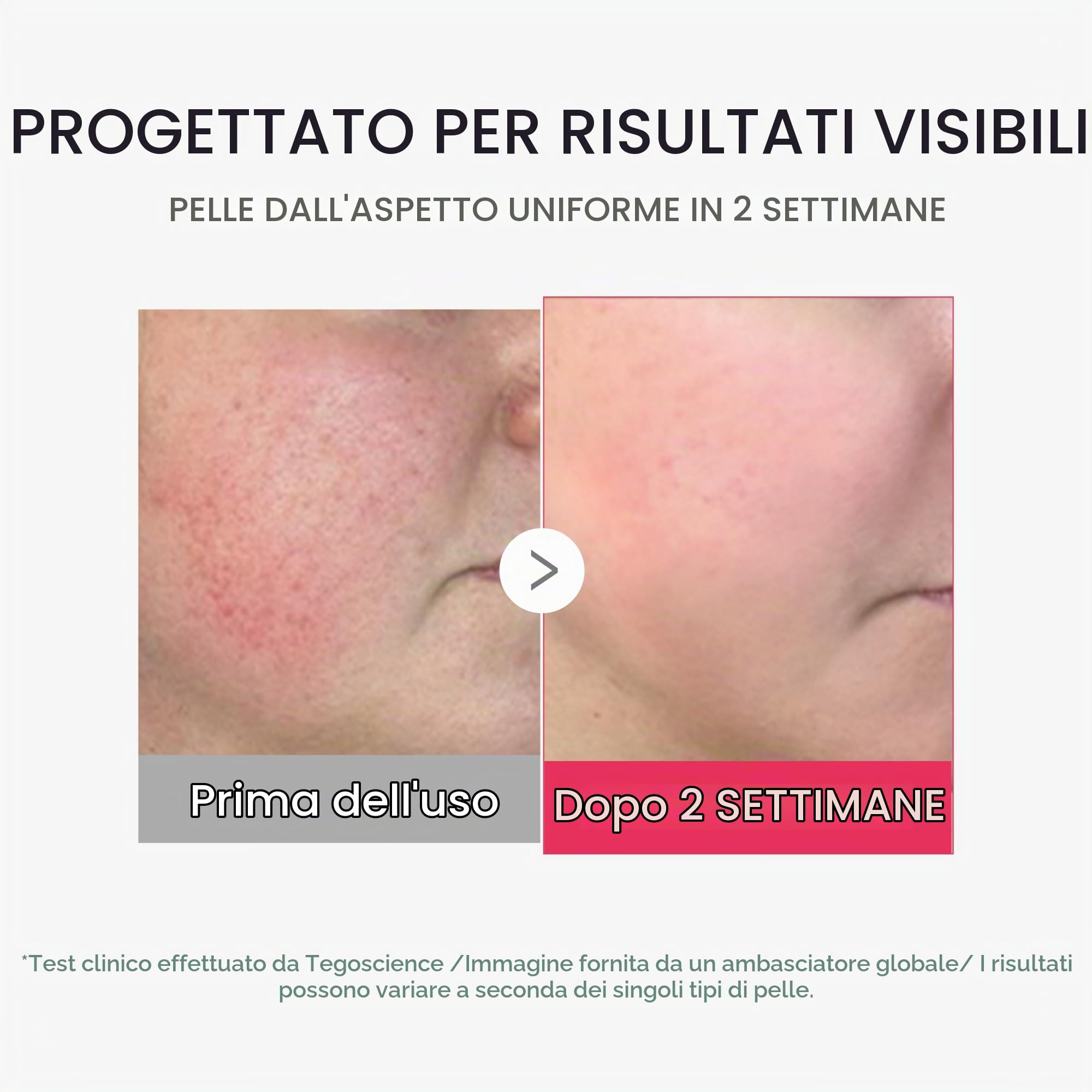 medicube Mini Booster Pro Plus | Dispositivo Viso per Luminosità, Effetto Lenitivo & Elasticità, 3 Modalità, Dispositivo Portatile per Skincare Coreana, Rosa