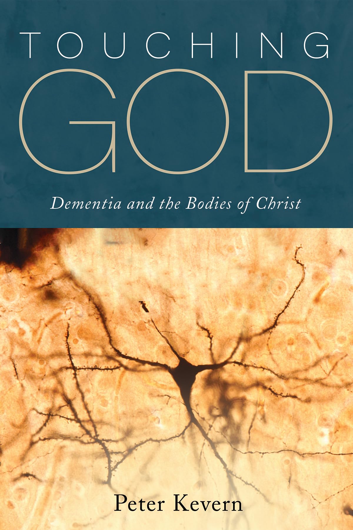 Touching God: Dementia and the Bodies of Christ