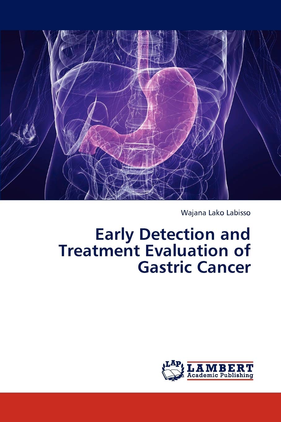 Early Detection and Treatment Evaluation of Gastric Cancer Paperback – Import, 25 December 2012