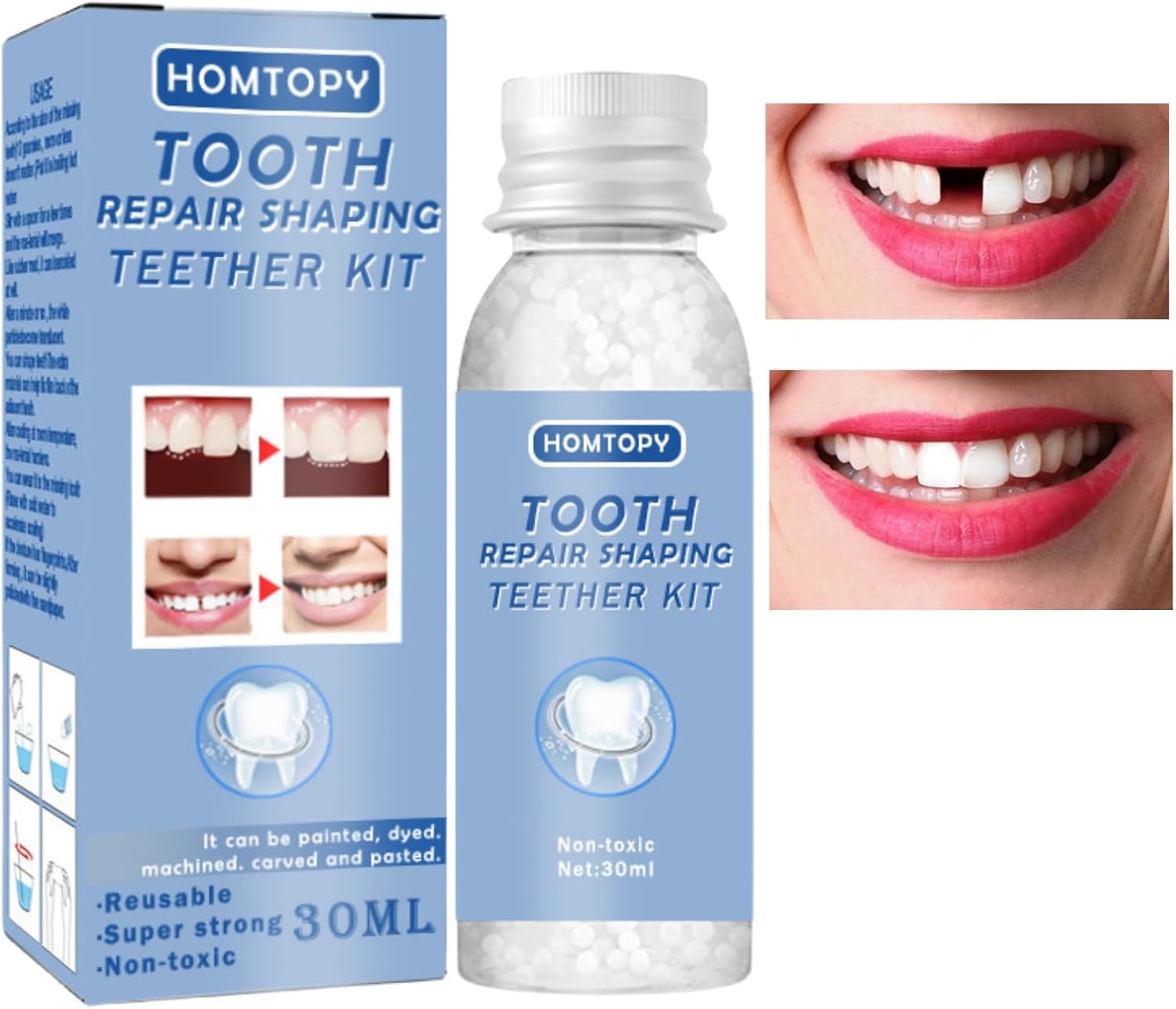 Temporary Tooth Filling,Tooth Filling Repair Kit,Dental Tooth Filler