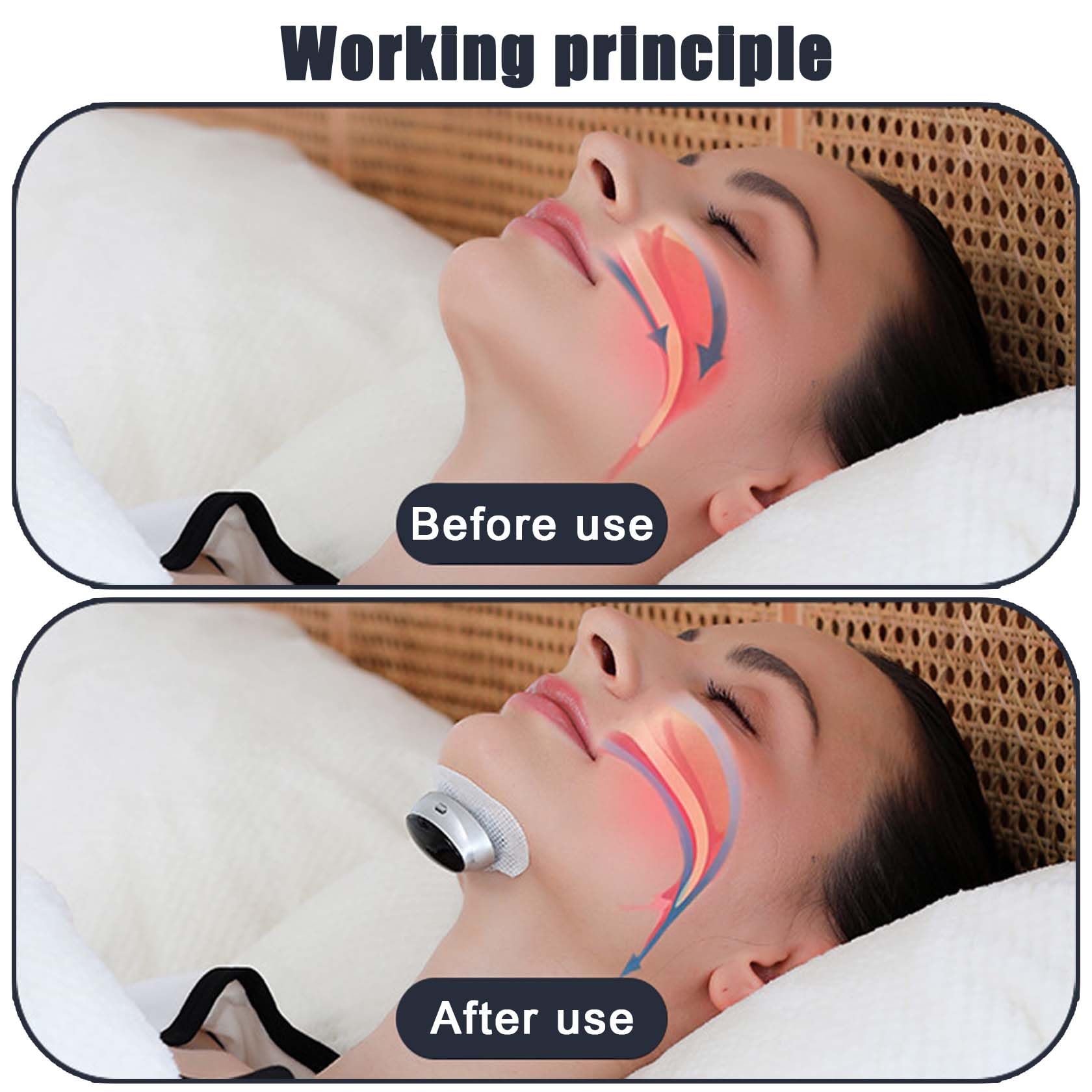 Dispositivo Inteligente De Pulsos con Estuche De Carga Magnética, Dispositivo para Dormir Que Reduce Eficazmente Los Ronquidos En Hombres Y Mujeres, Dispositivo Antironquidos Ultraligero Y