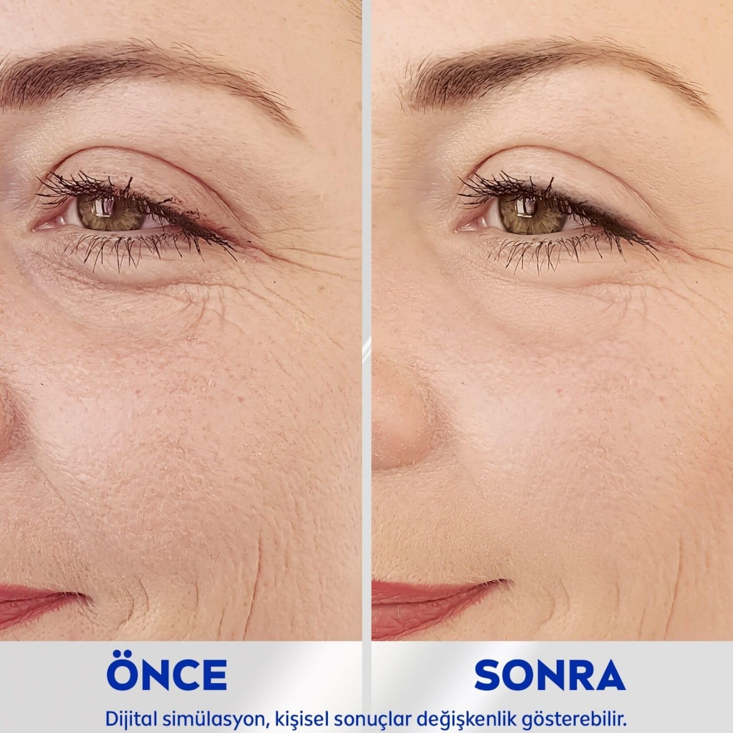 NIVEA Q10 Anında Etkili Kırışıklık Karşıtı Serum 15 ml,%5 Aktif Bileşen, Saf Q10 ve Petitler İçeren Cilt Serumu, 5 Dakikada Etki