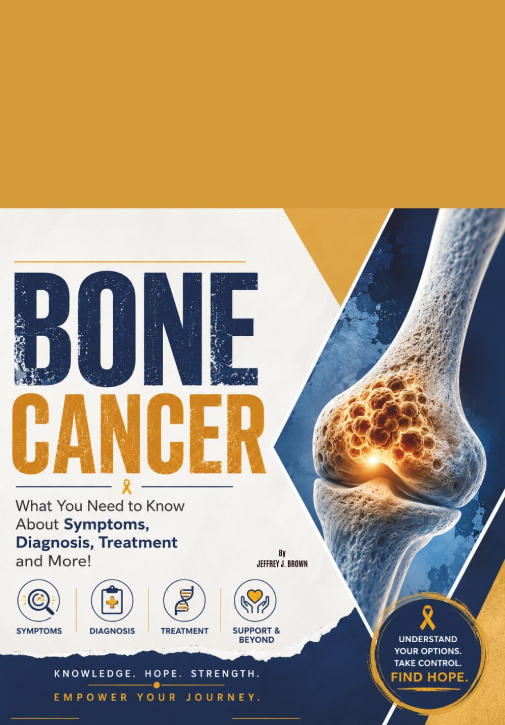 Bone cancer: What You Need to Know About Symptoms, Diagnosis, Treatment and More!