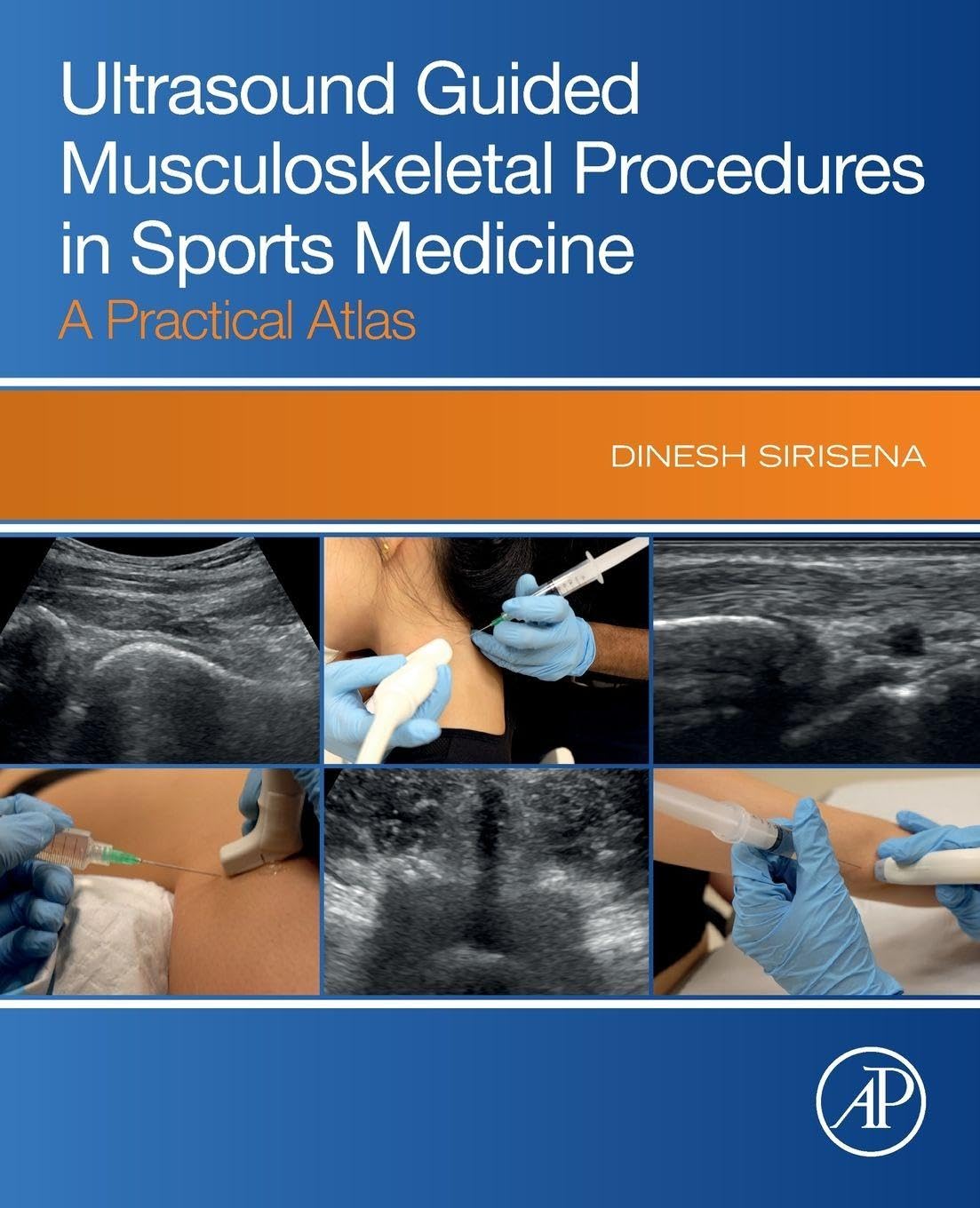 Ultrasound Guided Musculoskeletal Procedures in Sports Medicine: A Practical Atlas