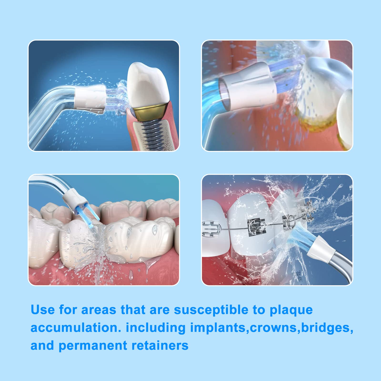 Flosser Replacement Tips for Waterpik Water Flosser,Plaque Seeker Replacement Tips Compatible with Waterpik Water Flossers and Other Brand Oral Irrigators - Image 4