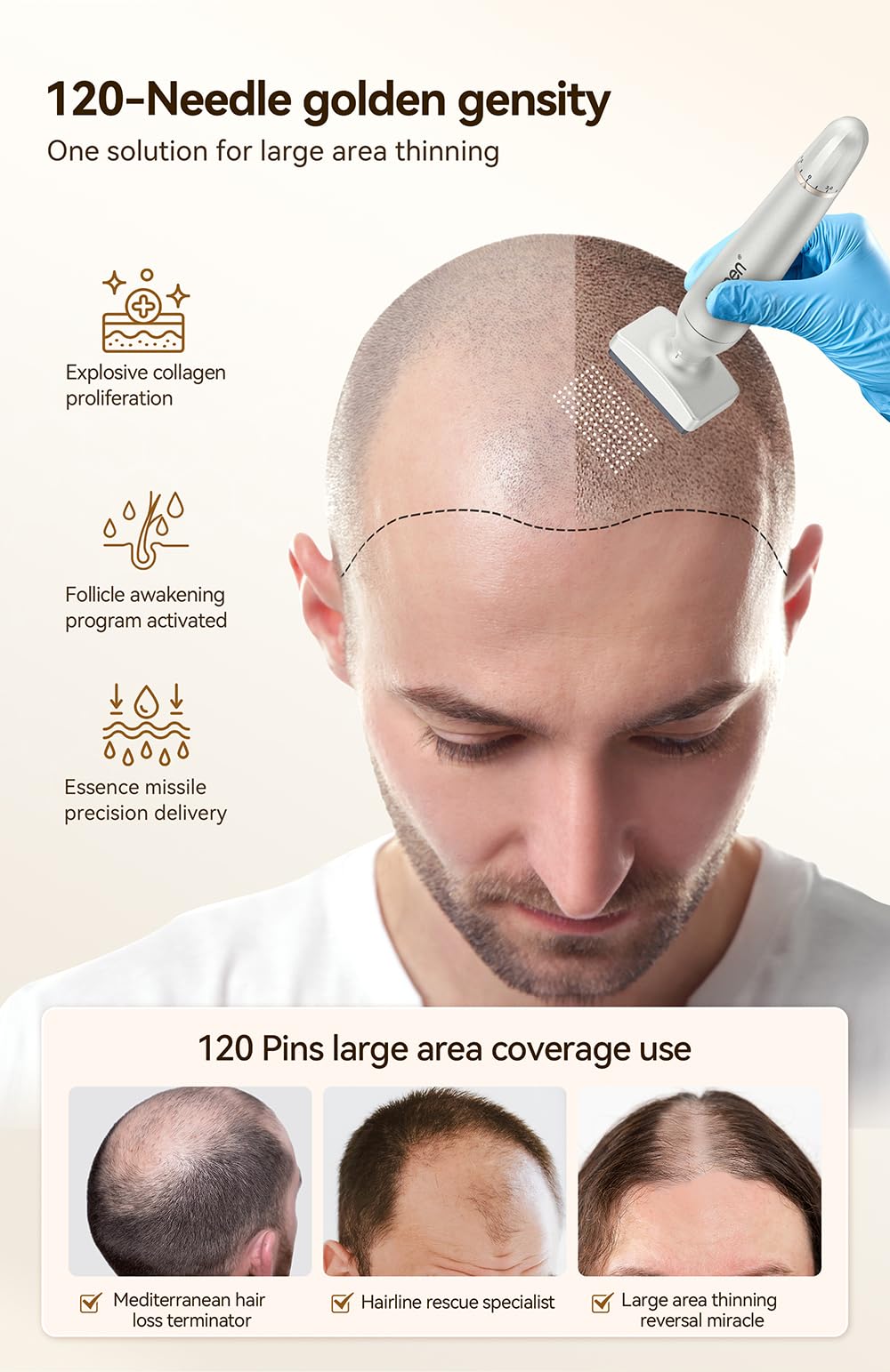 Derma Stamp Outil professionnel réglable en titane 0–3 mm – Croissance des cheveux et de la barbe, soins du visage et du corps – Alternative à un usage domestique pour Derma Roller et stylo – Hommes
