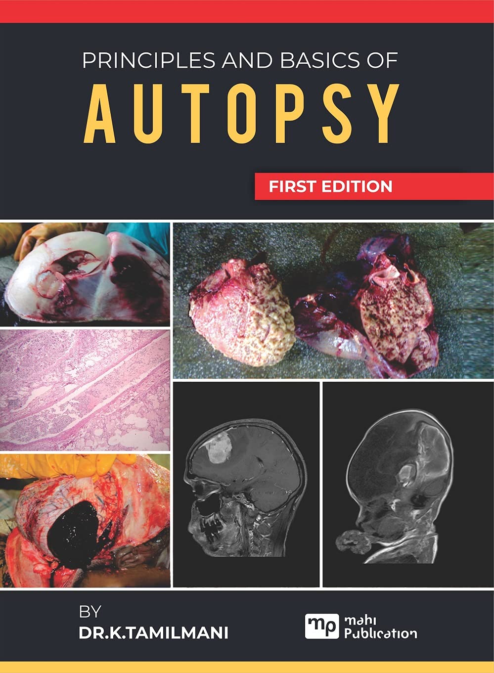PRINICIPLES AND BASICS OF AUTOPSY [Paperback] DR.K. TAMILMANI Paperback – 1 January 2021