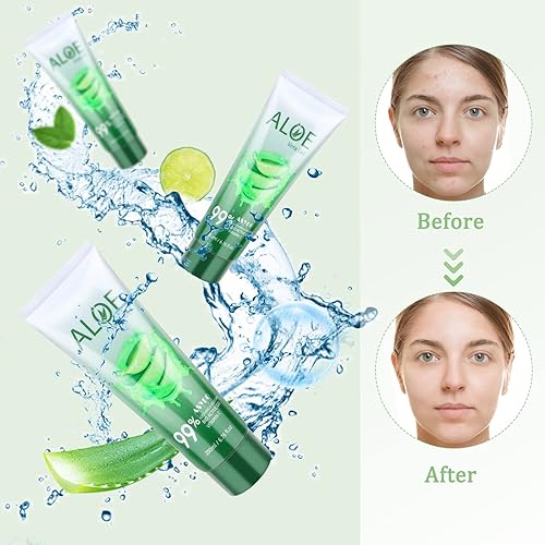 Miniatura 4 de Gel de aloe vera de 200 x 0.1 fl oz, 99% orgánico puro aloe vera hidratante facial y corporal, crema de aloe natural para piel seca, quemaduras