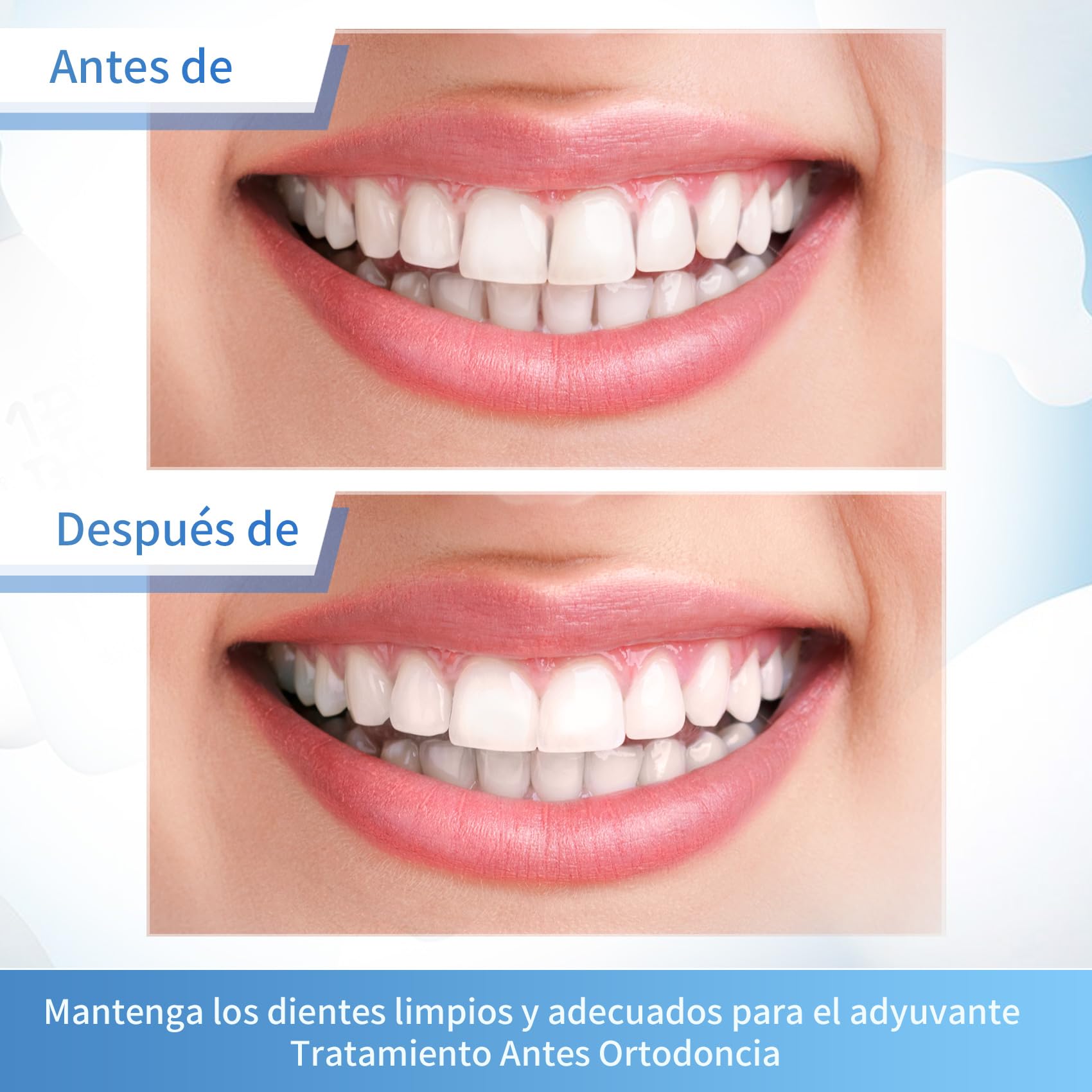 Annhua Tiras de Pulido Dental Abrasivo y Acabado 4mm x 6M Fine Azul