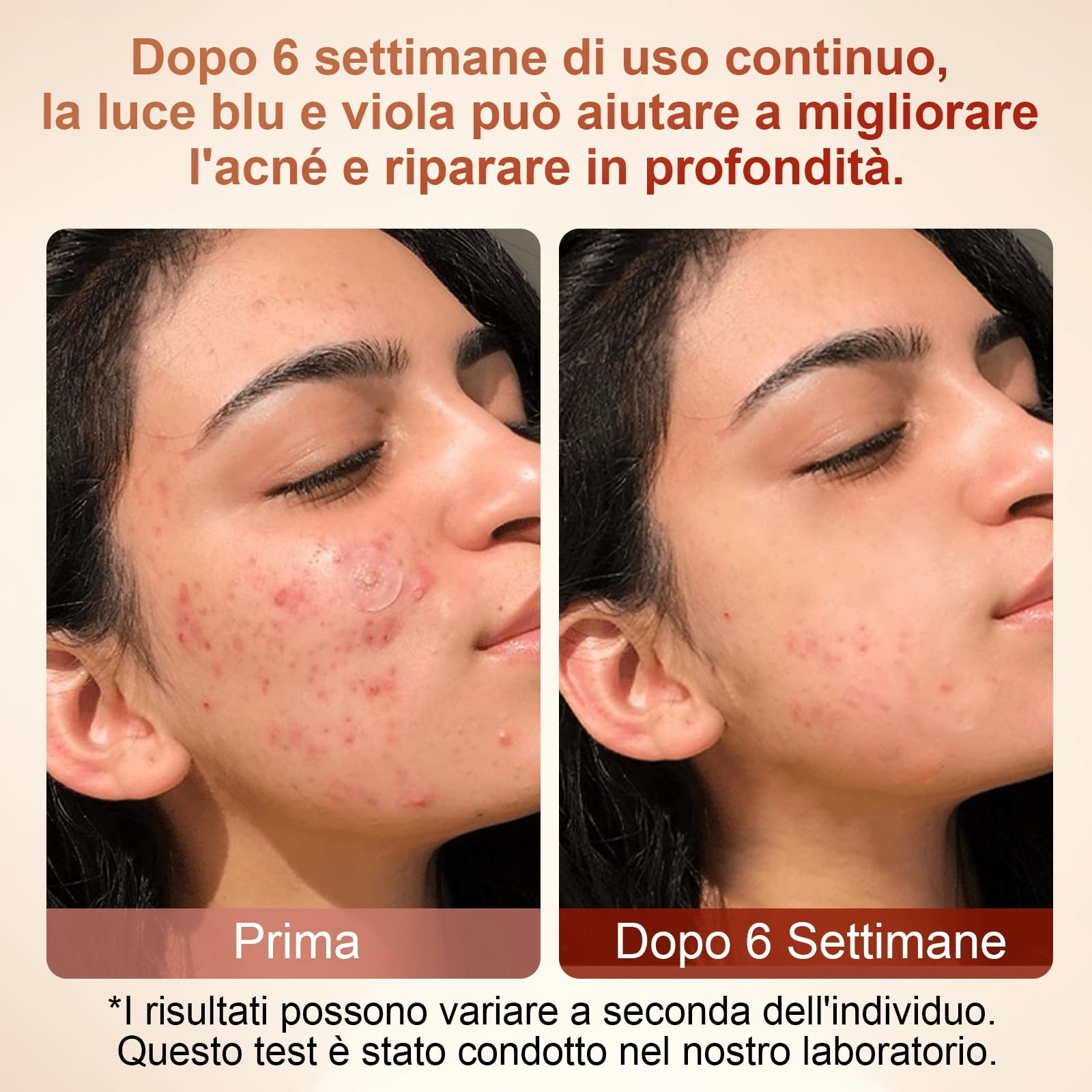 Maschera LED Viso, 4 Colori di Luce, Senza Fili in Silicone Morbido con Temporizzatore, per Cura Quotidiana del Viso