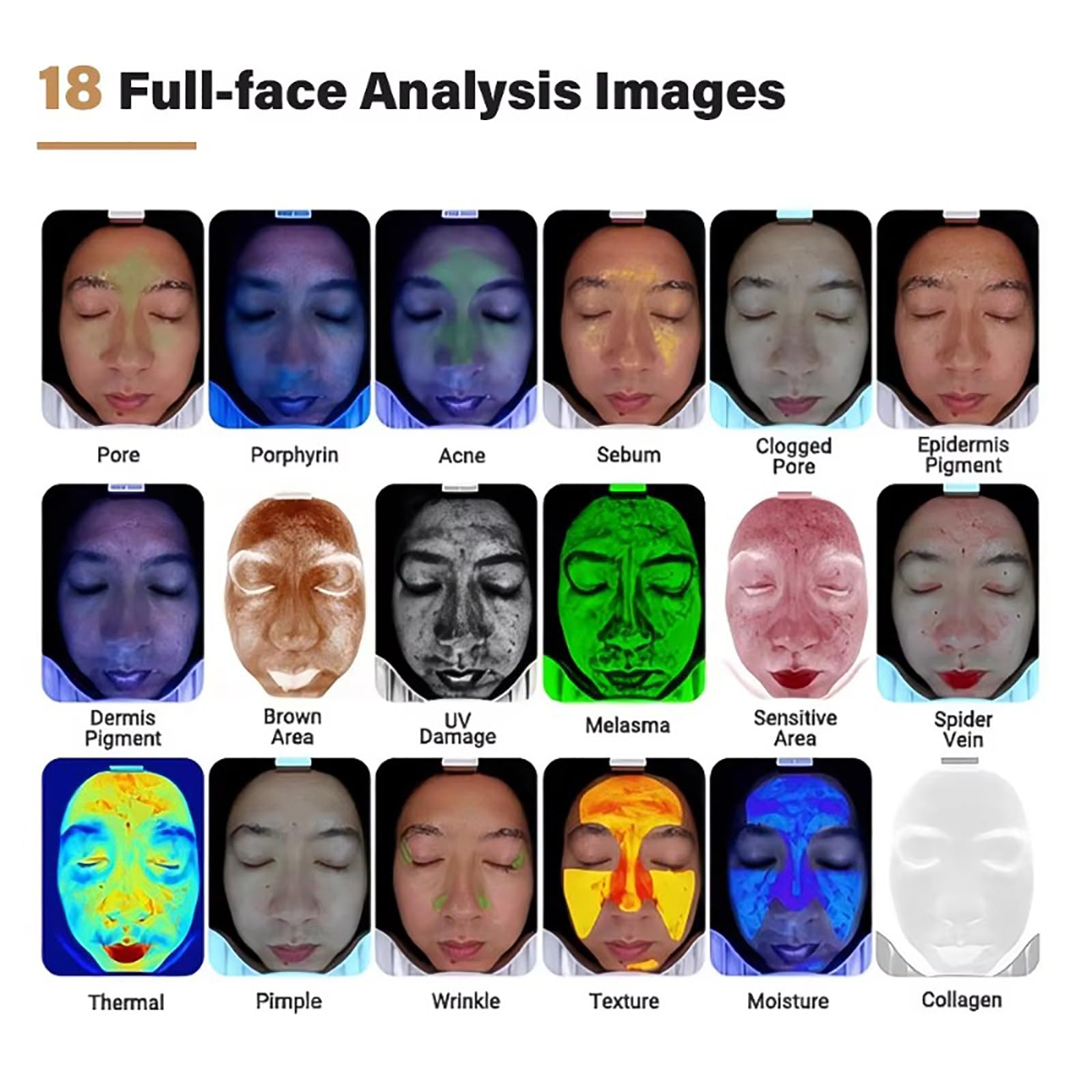 Analizador De Piel con IA De 15,6″, Escáner De Cabello Y Piel 2 En 1, 10 Modos De Imagen Espectral | 18 Indicadores De Análisis | 5 Predicciones De Síntomas Cutáneos, con Protector De Luz