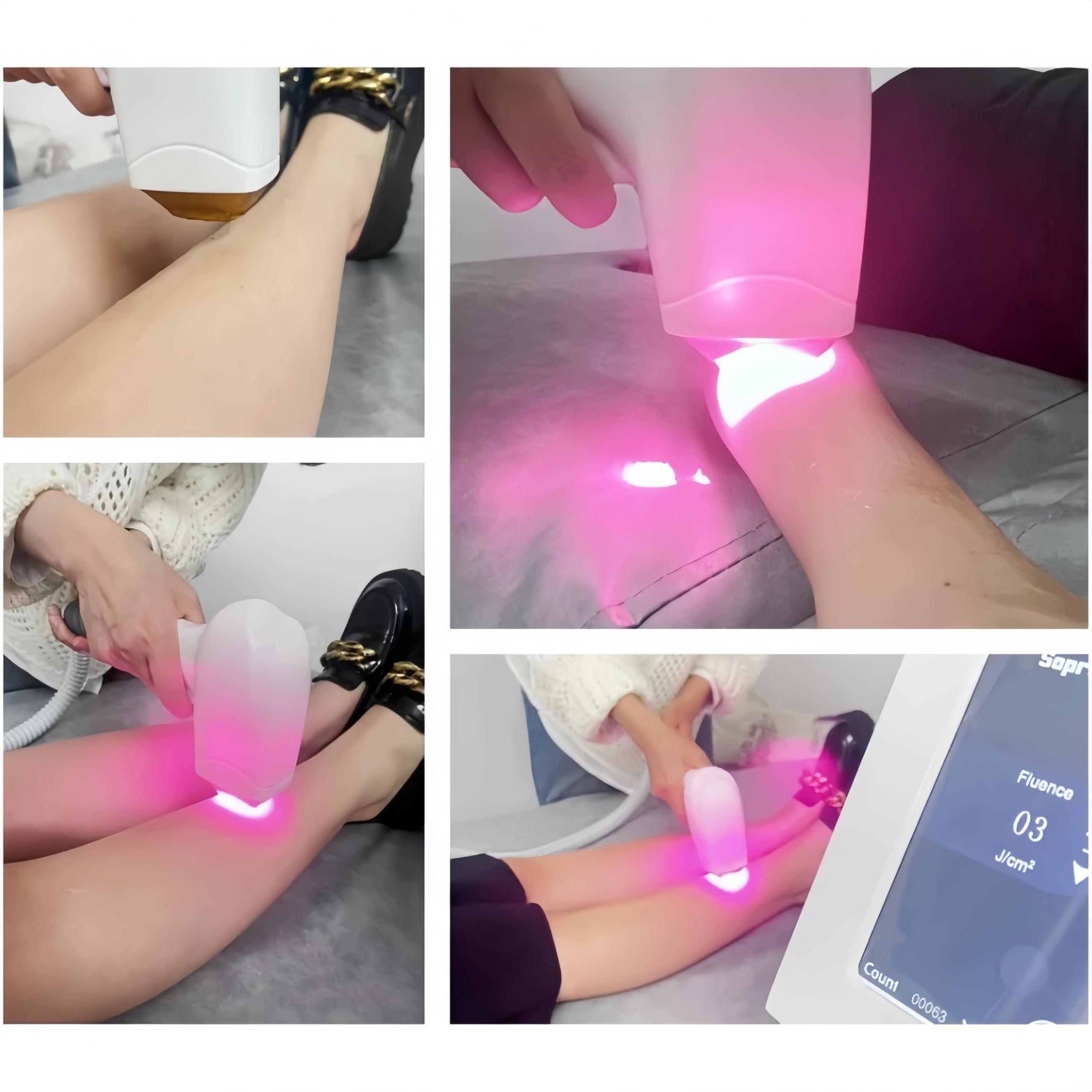 Macchina 808NM 755NM 940NM 1064NM di rimozione dei peli del corpo del laser del titanio del ghiaccio del diodo professionale dell'attrezzatura di alessandrite 4-onda permanente