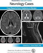 Pediatric Collections: Neurology Cases: Case Reports from Pediatrics in Review