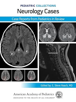 Pediatric Collections Neurology Cases Case Reports from Pediatrics in Review
