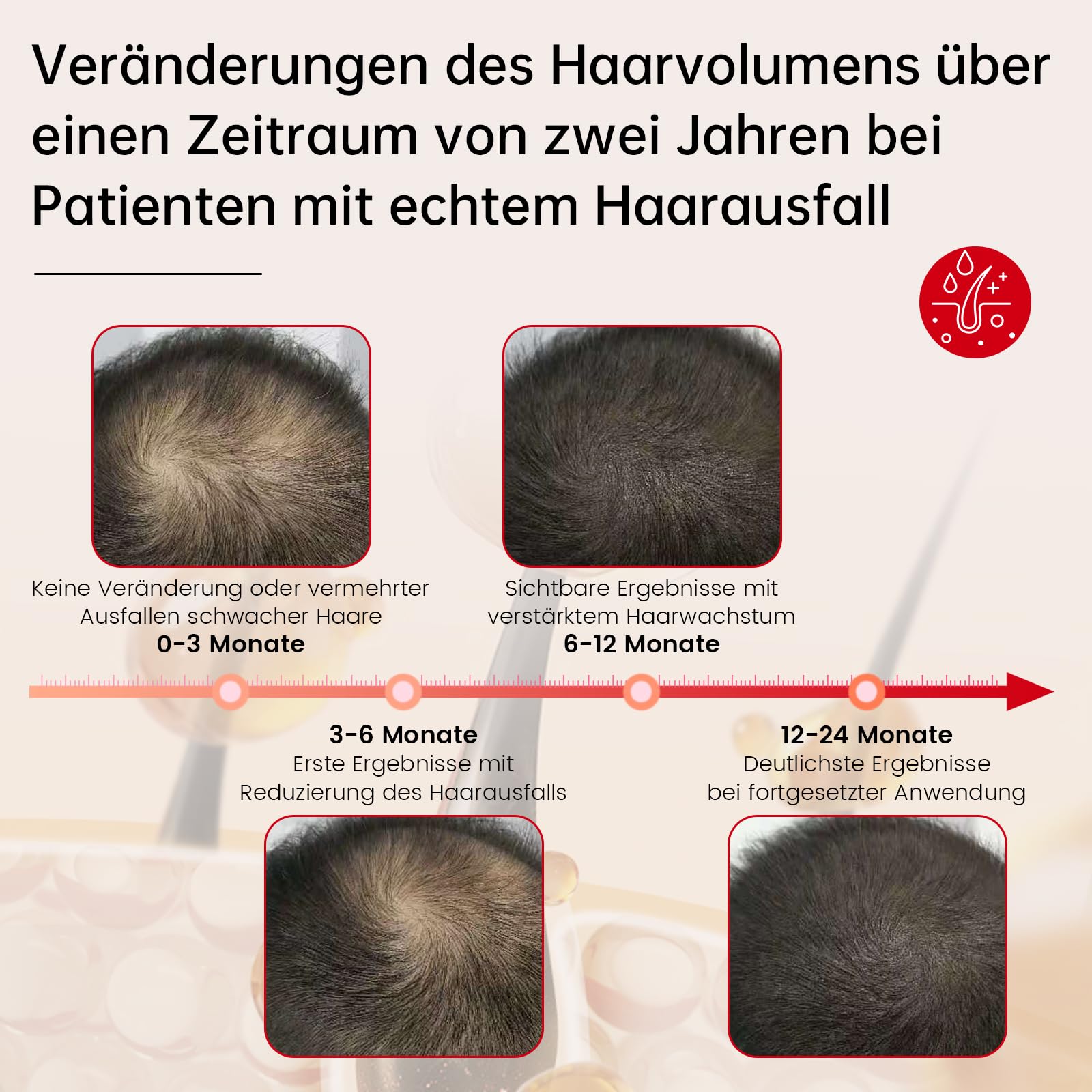 Laser Haarwachstum Cap für Haarwachstum Beschleunigen, 238 Laser und LED-Lampenperlen, 665nm Laser + 660nm Rotlicht+ 850nm Infrarotlicht, Haarfollikelaktivität zu steigern und Haarausfall vorzubeugen