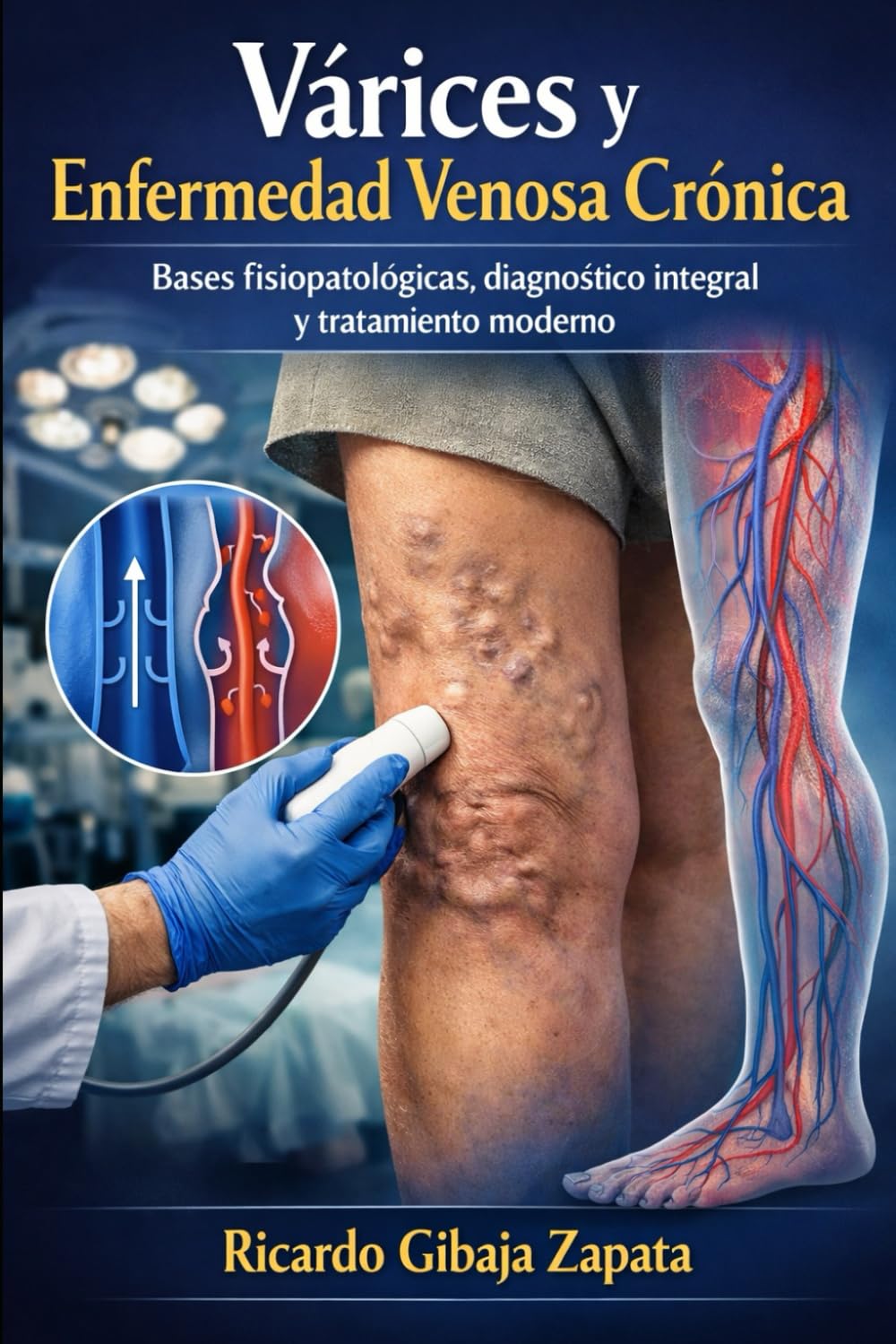Enfermedad Venosa Crónica y Varices Bases Fisiopatológicas, Diagnóstico Avanzado y Manejo Integral