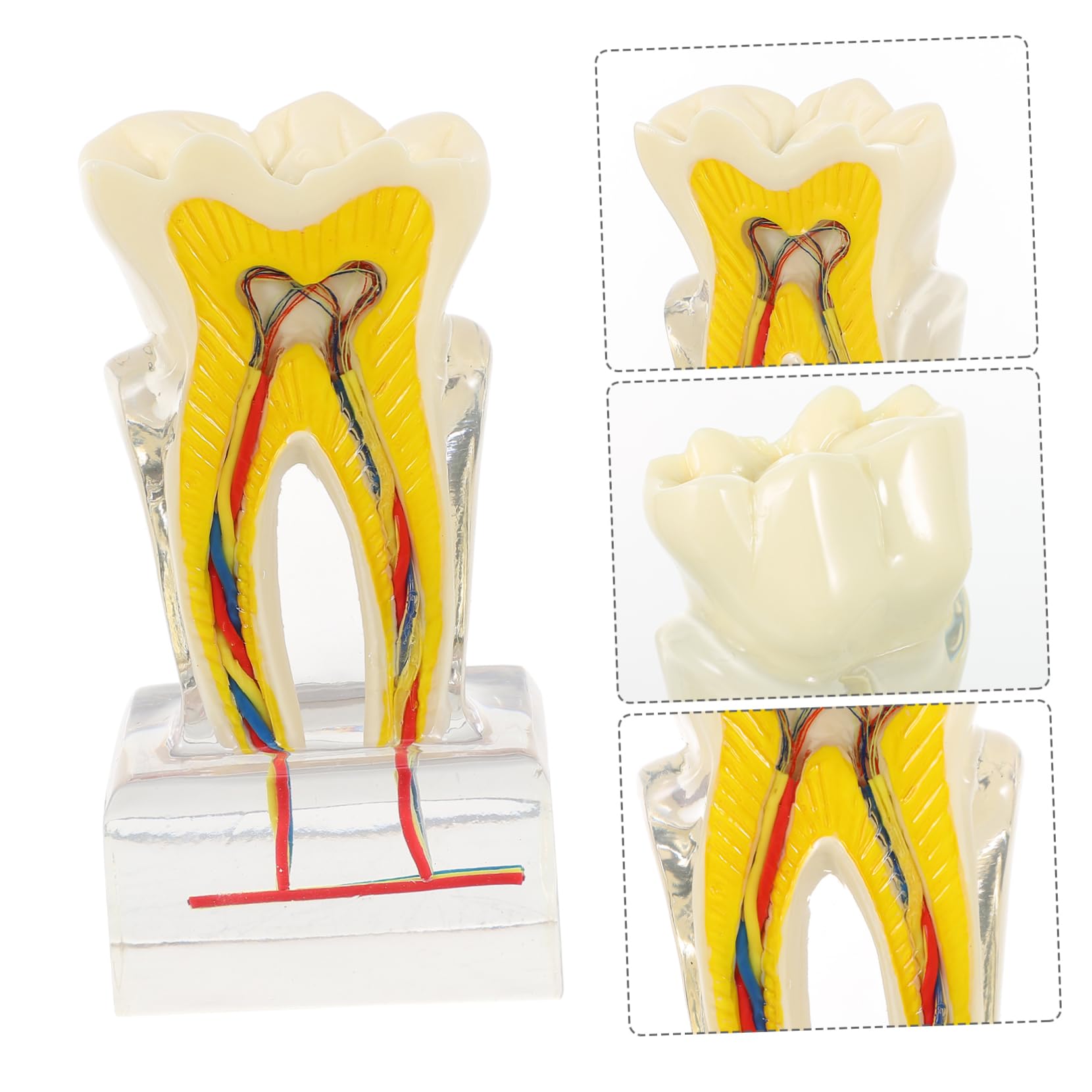 PRETYZOOM 6volte Modello Di Denti Dentali Modello Di Studio Per Per Lezioni Di Odontoiatria Dimostrazione Di Impianto e Protesi Fissa